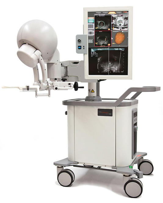 Artemis™ MR-TRUS füzyon biyopsi sistemi.
